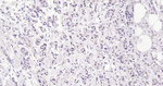 GATA3 Antibody in Immunohistochemistry (Paraffin) (IHC (P))