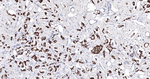 GATA3 Antibody in Immunohistochemistry (Paraffin) (IHC (P))