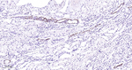 GATA3 Antibody in Immunohistochemistry (Paraffin) (IHC (P))