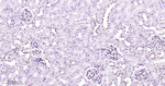 GATA3 Antibody in Immunohistochemistry (Paraffin) (IHC (P))