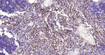 CD74 Antibody in Immunohistochemistry (Paraffin) (IHC (P))