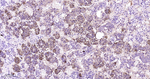 ACTH Recombinant Rabbit Monoclonal Antibody (A1H9)