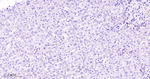 ACTH Antibody in Immunohistochemistry (Paraffin) (IHC (P))