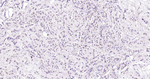 Estrogen Receptor alpha Recombinant Rabbit Monoclonal Antibody (5E20)