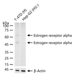 Estrogen Receptor alpha Antibody in Western Blot (WB)