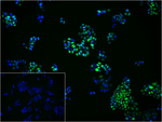 Progesterone Receptor Recombinant Rabbit Monoclonal Antibody (9A7)