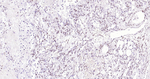 Progesterone Receptor Antibody in Immunohistochemistry (Paraffin) (IHC (P))