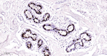 Progesterone Receptor Antibody in Immunohistochemistry (Paraffin) (IHC (P))