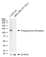 Progesterone Receptor Antibody in Western Blot (WB)