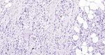 p53 Antibody in Immunohistochemistry (Paraffin) (IHC (P))