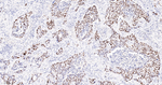 p53 Antibody in Immunohistochemistry (Paraffin) (IHC (P))