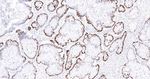 p53 Antibody in Immunohistochemistry (Paraffin) (IHC (P))