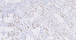 p53 Antibody in Immunohistochemistry (Paraffin) (IHC (P))