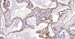 Caveolin 1 Recombinant Rabbit Monoclonal Antibody (19E17)