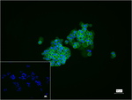 E-cadherin Recombinant Rabbit Monoclonal Antibody (B8F3)