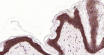E-cadherin Antibody in Immunohistochemistry (Paraffin) (IHC (P))