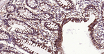 E-cadherin Antibody in Immunohistochemistry (Paraffin) (IHC (P))