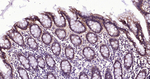E-cadherin Antibody in Immunohistochemistry (Paraffin) (IHC (P))