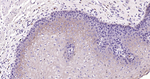 E-cadherin Antibody in Immunohistochemistry (Paraffin) (IHC (P))