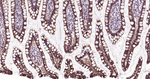 E-cadherin Antibody in Immunohistochemistry (Paraffin) (IHC (P))