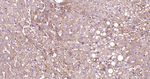 E-cadherin Antibody in Immunohistochemistry (Paraffin) (IHC (P))