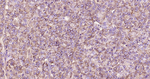 E-cadherin Antibody in Immunohistochemistry (Paraffin) (IHC (P))