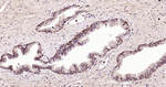 E-cadherin Antibody in Immunohistochemistry (Paraffin) (IHC (P))