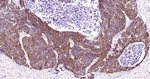 Cytokeratin 14 Recombinant Rabbit Monoclonal Antibody (1C11)
