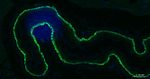 Cytokeratin 14 Antibody in Immunohistochemistry (Paraffin) (IHC (P))