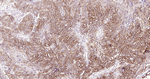 Cytokeratin 14 Antibody in Immunohistochemistry (Paraffin) (IHC (P))