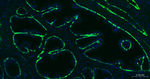 Cytokeratin 14 Antibody in Immunohistochemistry (Paraffin) (IHC (P))