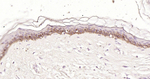 Cytokeratin 14 Antibody in Immunohistochemistry (Paraffin) (IHC (P))