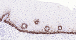 Cytokeratin 14 Antibody in Immunohistochemistry (Paraffin) (IHC (P))