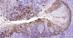 Cytokeratin 14 Antibody in Immunohistochemistry (Paraffin) (IHC (P))