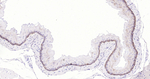 Cytokeratin 14 Antibody in Immunohistochemistry (Paraffin) (IHC (P))