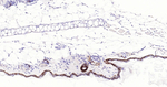 Cytokeratin 14 Antibody in Immunohistochemistry (Paraffin) (IHC (P))