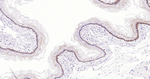 Cytokeratin 14 Antibody in Immunohistochemistry (Paraffin) (IHC (P))