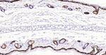 Cytokeratin 14 Antibody in Immunohistochemistry (Paraffin) (IHC (P))