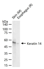 Cytokeratin 14 Antibody in Western Blot (WB)