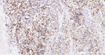 Prostate Specific Acid Phosphatase Recombinant Rabbit Monoclonal Antibody (10G17)