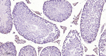 p27Kip1 Antibody in Immunohistochemistry (Paraffin) (IHC (P))