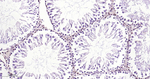 p27Kip1 Antibody in Immunohistochemistry (Paraffin) (IHC (P))