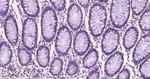 p27Kip1 Antibody in Immunohistochemistry (Paraffin) (IHC (P))