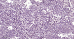 p27Kip1 Antibody in Immunohistochemistry (Paraffin) (IHC (P))