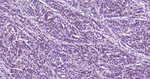 p27Kip1 Antibody in Immunohistochemistry (Paraffin) (IHC (P))