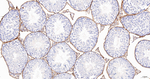 CD34 Antibody in Immunohistochemistry (Paraffin) (IHC (P))