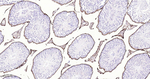 CD34 Antibody in Immunohistochemistry (Paraffin) (IHC (P))