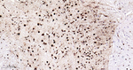 TDP-43 Antibody in Immunohistochemistry (Paraffin) (IHC (P))