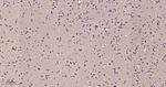 LC3B Recombinant Rabbit Monoclonal Antibody (7D10)