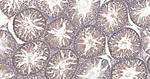 LC3B Antibody in Immunohistochemistry (Paraffin) (IHC (P))